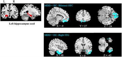 Family Conflict Associated With Intrinsic Hippocampal-OFC Connectivity in Adolescent Depressive Disorder